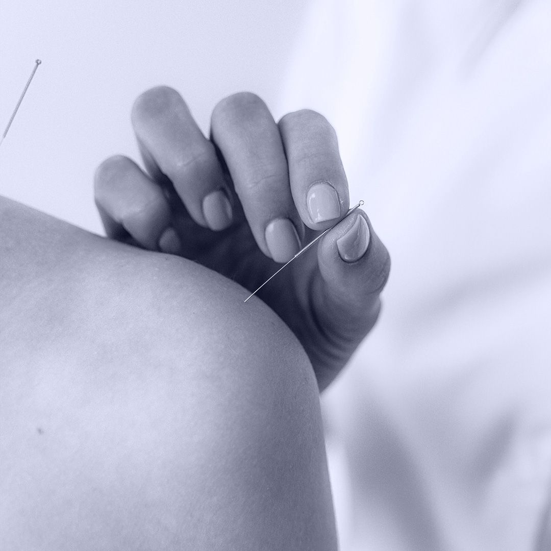 Mapa de evidencia acupuntura acupuncture evidence map